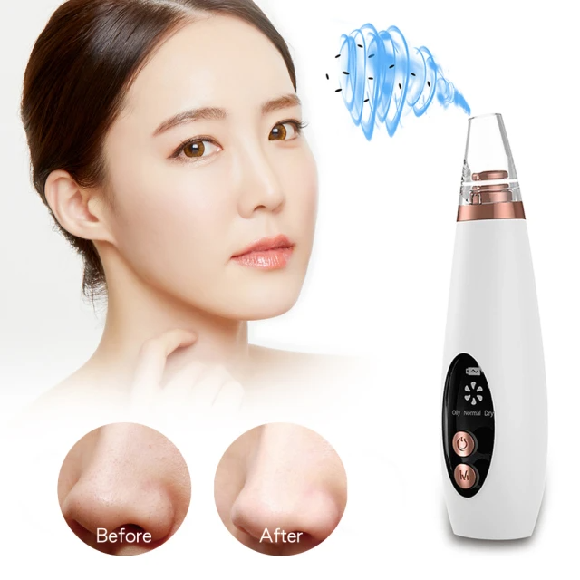 黑頭粉刺毛孔清潔機